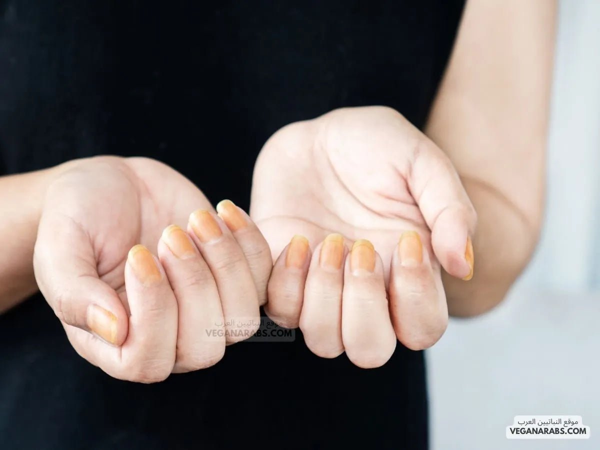 أسباب اصفرار الأظافر وتشققها - Delia Cosmetics